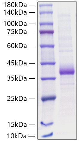 Recombinant Human Carbonic anhydrase 5A/CA5A Protein