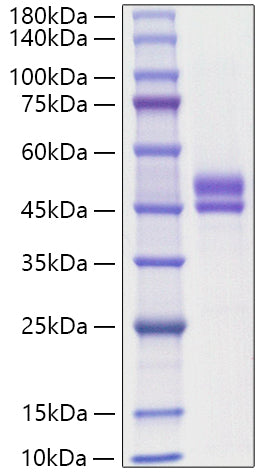 Recombinant Human WFDC2/HE4/WAP5 Protein