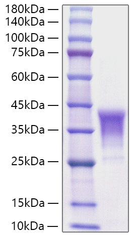 Recombinant Human TNFSF8/CD30L Protein