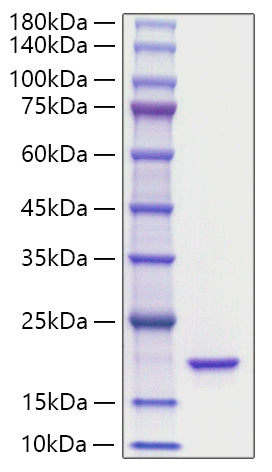 Recombinant Mouse IL-36Ra/IL-1F5 Protein