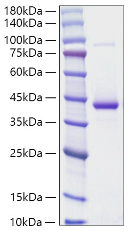 Recombinant Human RETN Protein