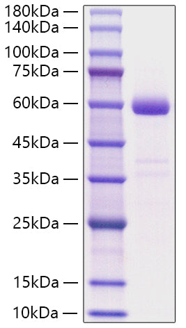 Recombinant Human NBL1 Protein