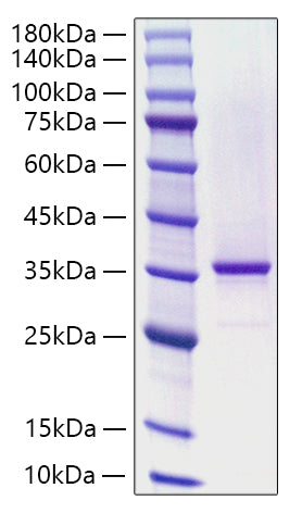 Recombinant Human KLHL20 Protein