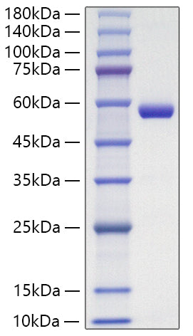 Recombinant Human Lipocalin-2/NGAL/LCN2 Protein