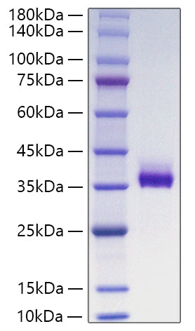 Recombinant Human Angiopoietin-like 3/ANGPTL3 Protein