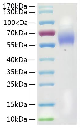 Recombinant Mouse Galectin-9/LGALS9 Protein