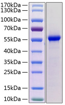 Recombinant Mouse Renin/REN1 Protein