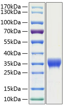 Recombinant Human SLAMF8/CD353 Protein