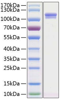 Recombinant Human Autotaxin/E-NPP2 Protein