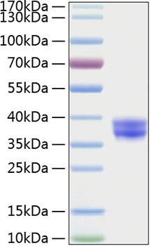 Recombinant Human CADM3/IGSF4B Protein