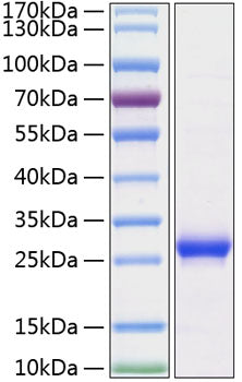 Recombinant Human TFPI-2 Protein