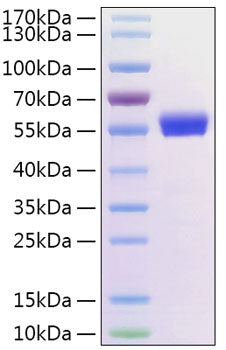 Recombinant Human ROR2 Protein