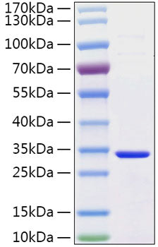 Recombinant Human Secretagogin/SCGN Protein