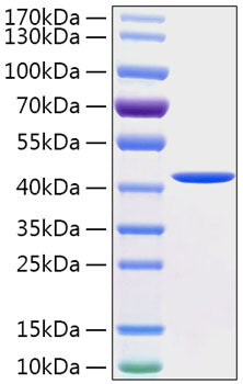 Recombinant Human Cathepsin E Protein