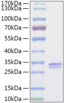 Recombinant Human VSIG2 Protein