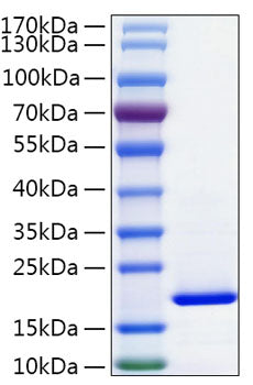 Recombinant Human FABP2/I-FABP Protein