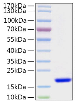 Recombinant Human FABP7/B-FABP/BLBP Protein