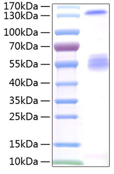 Recombinant Human IGF2BP2 Protein