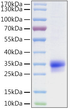 Recombinant Human CFHR2 Protein