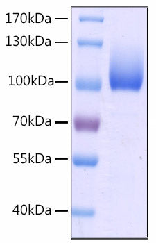 Recombinant Human CFHR4 Protein