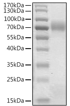 Recombinant Human Angiopoietin-like 8/ANGPTL8 Protein