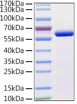 Recombinant Human TUBB4A Protein