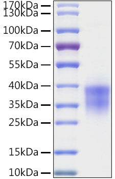 Recombinant Human Granzyme B Protein