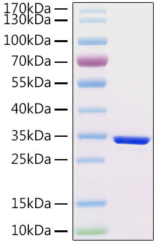 Recombinant Human CG-beta/CGB3 Protein