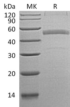Recombinant Human Calumenin Protein