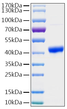 Recombinant Human PGK1 Protein