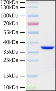 Recombinant Human Collagen II alpha 1/COL2A1 Protein