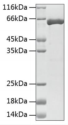 Recombinant Mouse Tyrosine Hydroxylase protein