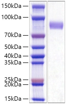 Recombinant Human AKT3 Protein