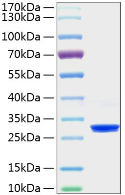 Recombinant Human PRDX4 Protein