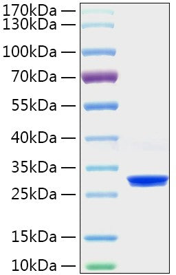 Recombinant Mouse TIMP-1 Protein