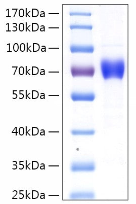 Recombinant Human CNDP1 Protein