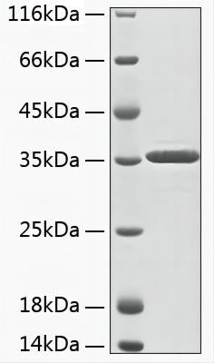 Recombinant Human ACY3 Protein