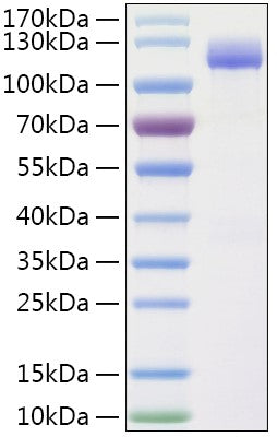 Recombinant Human IDE Protein