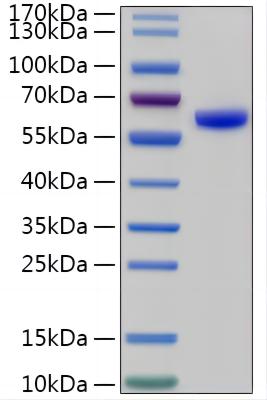 Recombinant Human Tripeptidyl-peptidase 1/TPP1 Protein