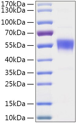 Recombinant Human CNDP2 Protein