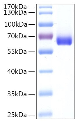 Recombinant Human Leukotriene A4 Hydrolase Protein