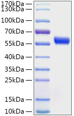 Recombinant Human Calreticulin/CALR Protein