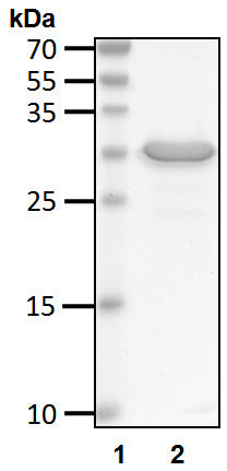 Recombinant Human E3 ubiquitin-protein ligase CHIP protein