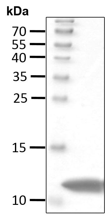 Recombinant Human Ubiquitin (K all R) protein