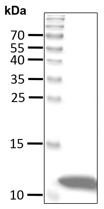 Recombinant Human Ubiquitin (K6 only) protein