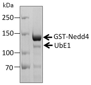 Recombinant Human E3 ubiquitin-protein ligase NEDD4 protein