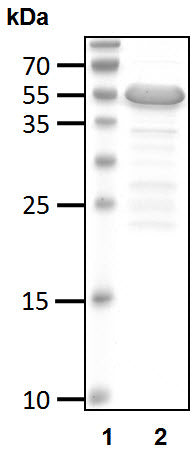 Recombinant Human RING-finger 4/RNF4 protein