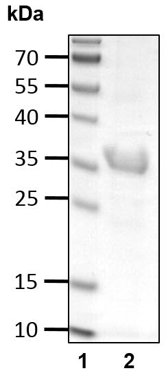 Recombinant Human Ubiquitin(1-75) protein