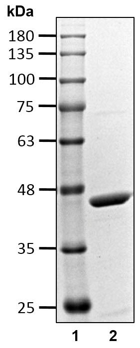 Recombinant Human Ubiquitin thioesterase OTU1 protein