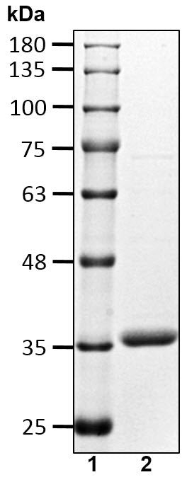 Recombinant Human Deubiquitinase OTUD6B protein